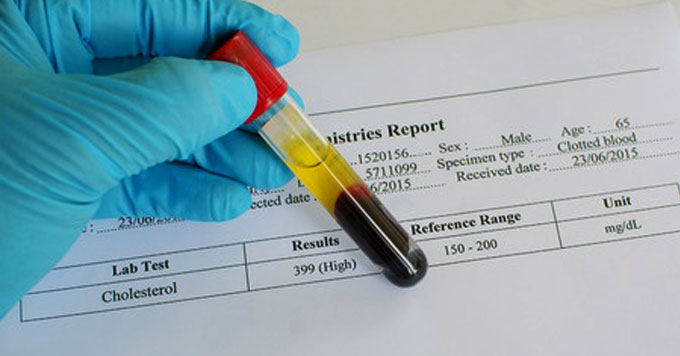 blood cholesterol test tube