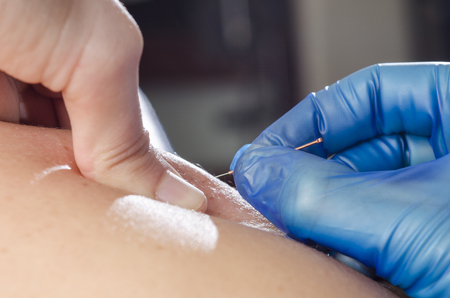 SHR # 2101 :: The BluePrint Power Hour + Dry Needling 101 ::