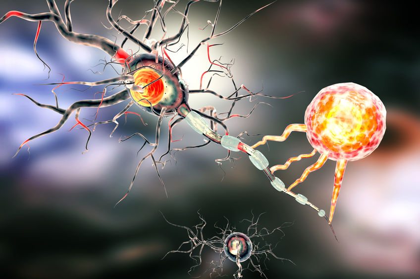 inflammatory disease