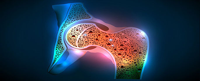 human hip joint and osteoporosis illustration