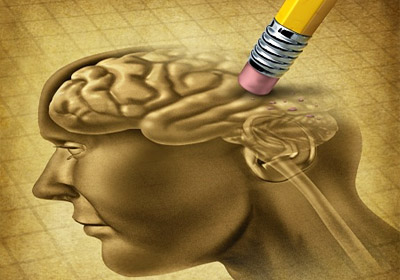 partially erased human brain illustration depicting memory loss 