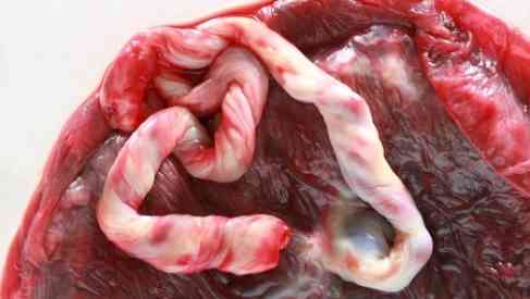 stem cell tissue
