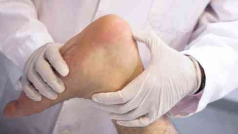 ankle