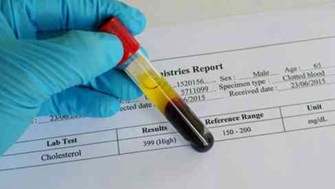 blood cholesterol test tube