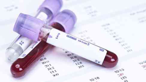 blood test tubes