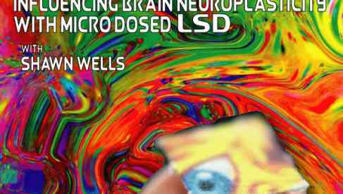 brain neuroplasticity