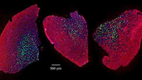 Epigenetic Testing Pattern