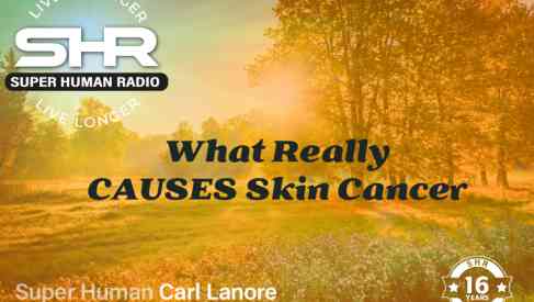 What Really CAUSES Skin Cancer
