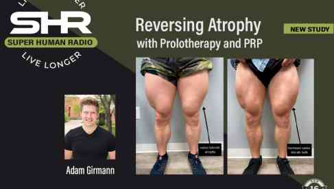 Reversing Atrophywith Prolotherapy and PRP; New Study