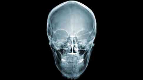 skull