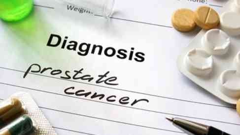 prostate cancer diagnosis