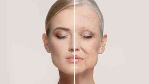 anti-aging