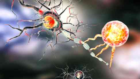 inflammatory disease