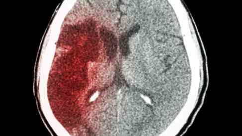 brain imagery